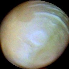 大豆种子质量分类数据集(5 类) 样本 3