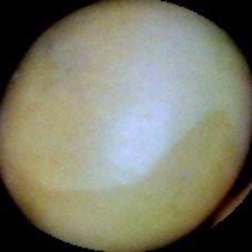 大豆种子质量分类数据集(5 类) 样本 5