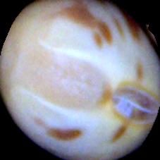 大豆种子损伤检测数据集（COCO 格式） 样本 5